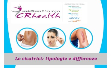 LE CICATRICI: TIPOLOGIE E DIFFERENZE LE CICATRICI: TIPOLOGIE E DIFFERENZE
